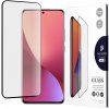 Dux Ducis Sklo s tvrdeným povrchom - Xiaomi 12 / 12X - Čierna