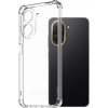 AlzaGuard Shockproof Case pre Xiaomi Redmi A5 AGD-PCTS484Zv2