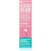 MomCare by Lina C-Section Silicone Scar Patches silikónové náplasti na jazvy po cisárskom reze veľkosť S-M 3x15 cm 3 ks