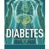 Diabetes: Prevencia, diagnostika, liečba - Rosemary Walker