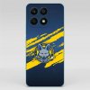 4NewCase - Kryt pre HONOR - Honor X8a - SILIKÓN - HK Žiar nad Hronom 4 - 1012900500131