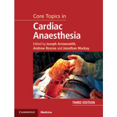 Core Topics in Cardiac Anaesthesia