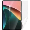 SES Ochranná fólie pro tablet Samsung Galaxy Tab A8 (SM-X200) 10531