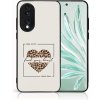 PROTEMIO 83040 MY ART Ochranný kryt pre Honor 70 WILD HEART (241)