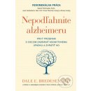 Kniha Nepodľahnite alzheimeru