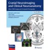 Cranial Neuroimaging and Clinical Neuroanatomy