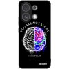 Picasee ULTIMATE CASE pro Xiaomi Redmi Note 13 4G - Brain - White