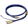 Ortofon 6NX-TSW 1010