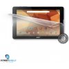 Screenshield™ ACER ICONIA One 10 B3-A30 fólia na displej