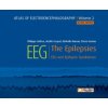 Atlas of Electroencephalography -- Volume 2