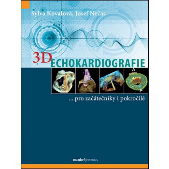 ​3D Echokardiografie - Kovalová Sylva; Nečas Josef