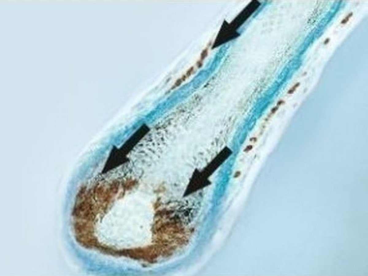 Výživa už od korienkov