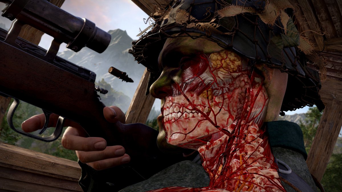 Strhujúce X-ray kill cam