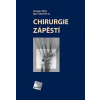 Chirurgie zápěstí