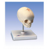 Foetal Skull Model, natural cast, 30th week of pregnancy, on stand (Anatomické modely)