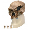 Anthropological Skull Model - Steinheim (Anatomické modely)