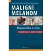 Maligní melanom - Diagnostika a léčba - Petr Arenberger