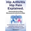 Hip Arthritis, Hip Pain Explained. Osteoarthritis in Hips, Rheumatoid Arthritis in Hips. Including Hip Arthritis Surgery, Hip Flexor Pain, Exercises,