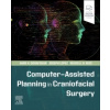 Computer-Assisted Planning in Craniofacial Surgery