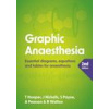 Graphic Anaesthesia, second edition (Tim Hooper,James Nickells,Sonja Payne,Annabel Pearson,Ben Walton)(Brožovaná)