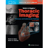 Webb & Higgins Thoracic Imaging: Print + eBook with Multimedia - Travis Scott Henry, Karen Gomes Ordovas
