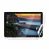 Screenshield IGET Smart W30 fólia na displej (IGT-SMW30-D)