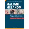 Maligní melanom: Diagnostika a léčba, 2. vydání