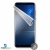 Screenshield CUBOT X18 fólie na displej (CUB-X18-D)