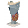 Funkčný hrtanový model, 2,5-krát životná veľkosť (Anatomické modely)