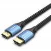 Video kábel Vention HDMI 4K HD Cable Aluminum Alloy Type 15M Blue (ALHSN)