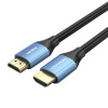 Vention ALHSH HDMI kábel 2 m Typ HDMI (štandard) Modrá (ALHSH)