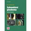 Sekundární glaukomy - Klára Samková