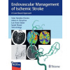 Endovascular Management of Ischemic Stroke - Vitor Pereira
