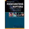 Poinfarktová ruptura - Petr Kačer a kolektív autorov