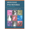 Spontánní pneumotorax