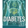 Diabetes: Prevencia, dia… (Rosemary Walker)