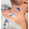 BEDAL FlexGRIP CVC 4,5-9 Fr s podkovou, Hydrocolloid (pro centrální katétry)