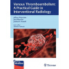 Venous Thromboembolism