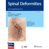Spinal Deformities : The Comprehensive Text