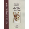 Zlomky Aischina zo Sfétta - Jaroslav Cepko