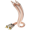 in-akustik Star II Audio Kabel Cinch - Cinch 0,75 m 00304107
