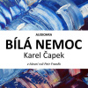 Bílá nemoc