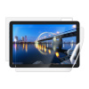 Screenshield IGET Smart L31 FullHD fólia na celé telo