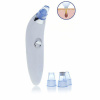 Vákuový čistič pleti DermaSuction - biela