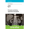 E-kniha CT - Průvodce technikou výpočetní tomografie - Lucie Súkupová