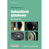 Sekundární glaukomy