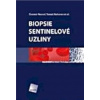 Biopsie sentinelové uzliny - Neoral Čestmír