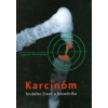 Karcinóm hrubého čreva a konečníka - Prochotský Augustín