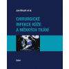 Chirurgické infekce kůže a měkkých tkání - Jan Ulrych et al.