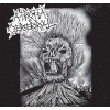 Atrofia Cerebral / Exacerbación split 8